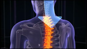Animation of abstract arrow that cure neck pain. Focused on spine. Futuristic background